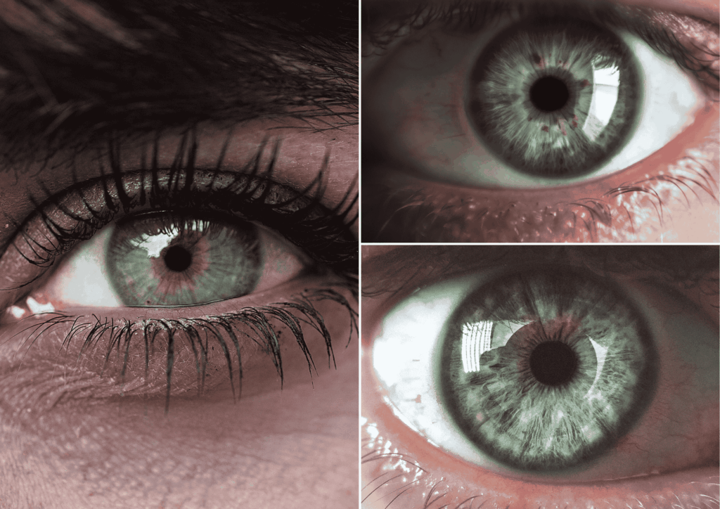 Diagnostika z očí, celostné zdravie, alternatívna medicina, riešenie príčiny, iris