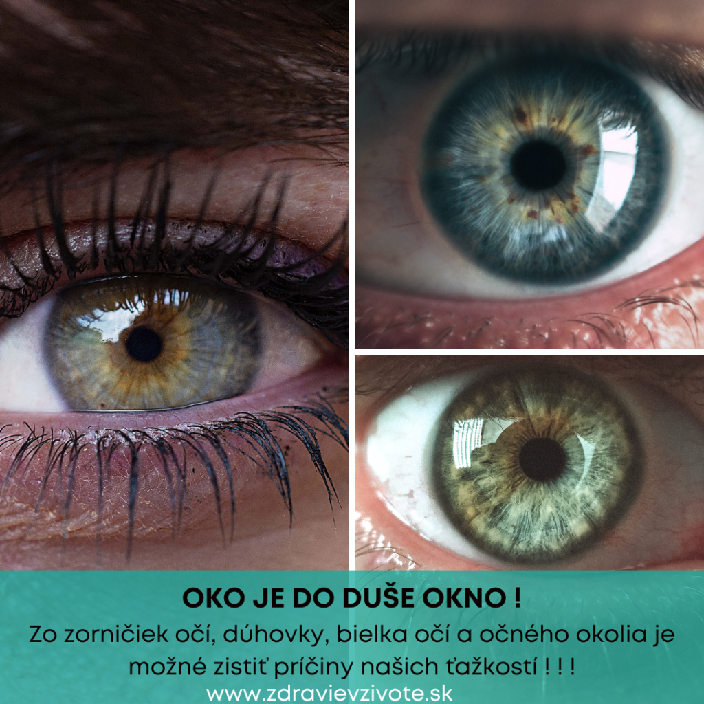 Zo zorničiek očí, dúhovky, bielka očí a očného okolia je možné zistiť príčiny našich ťažkostí !
