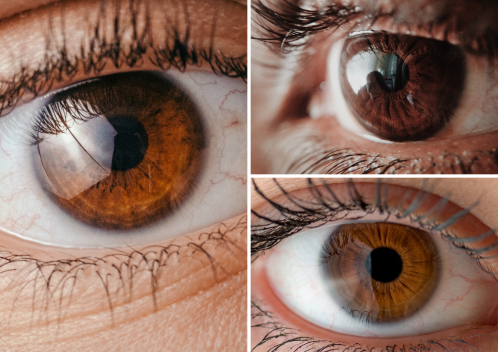 čítajte z očí príčiny zdravotných ťažkostí, oči a zdravotné problémy, čo znamenajú zmeny v oku, dúhovke a bielku oka