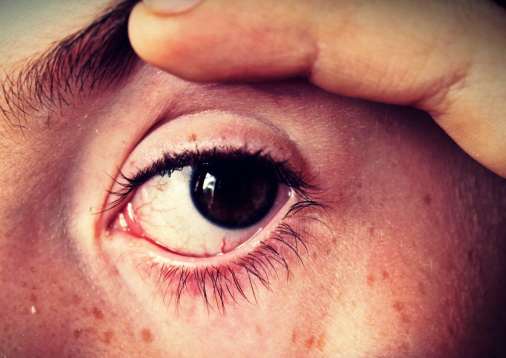 čítajte z očí príčiny zdravotných ťažkostí, oči a zdravotné problémy, čo znamenajú zmeny v oku, dúhovke a bielku oka